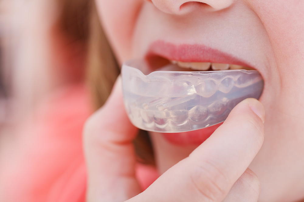 Mouthguards Healthy Smile Dental