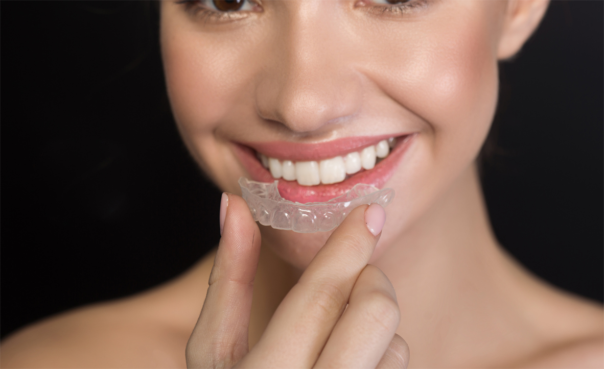 Straighter teeth with clear aligners