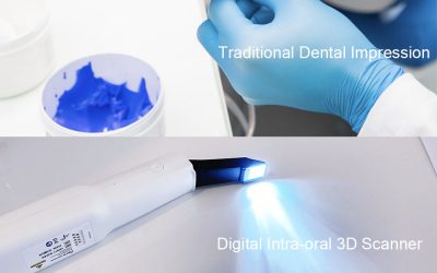 The top benefits of digital intraoral scanners