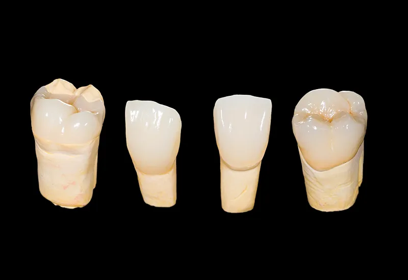 dental crowns