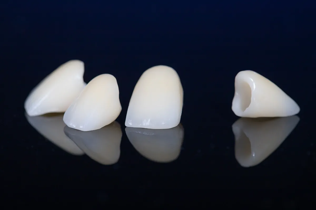 dental crowns