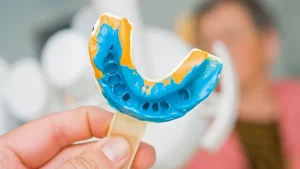 Custom mouthguards