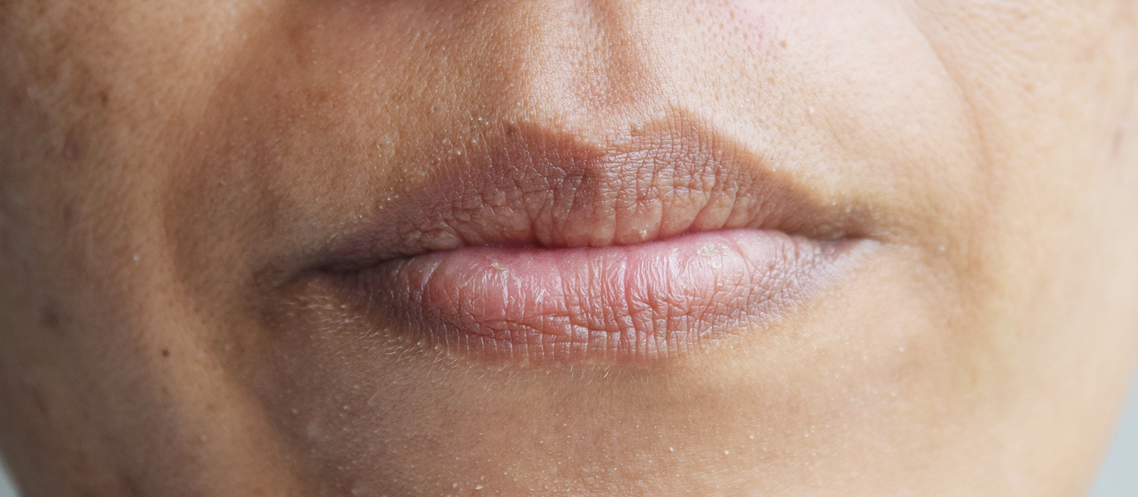 Why is your mouth always dry and is it normal