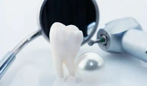Wisdom teeth